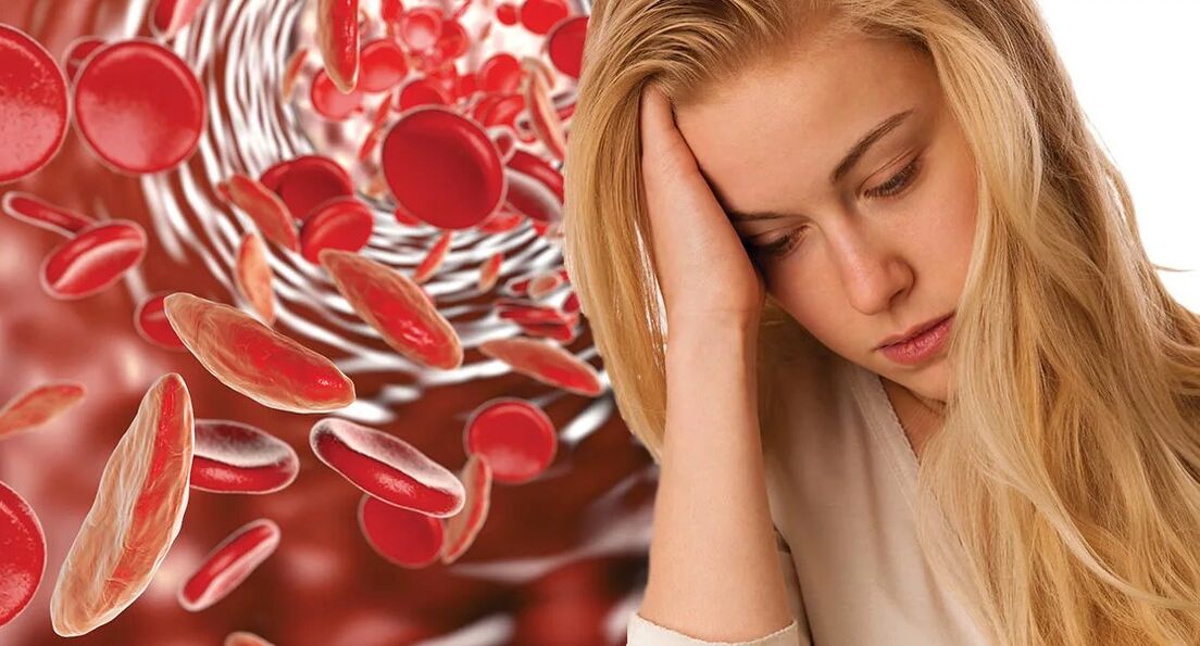 Anemija, kurią sukėlė parazitai